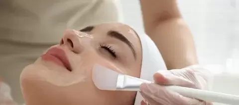 chemical peel 2