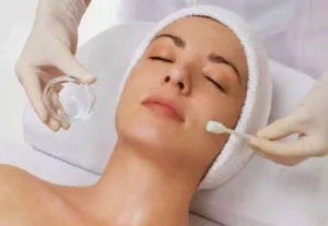 chemical peel featured